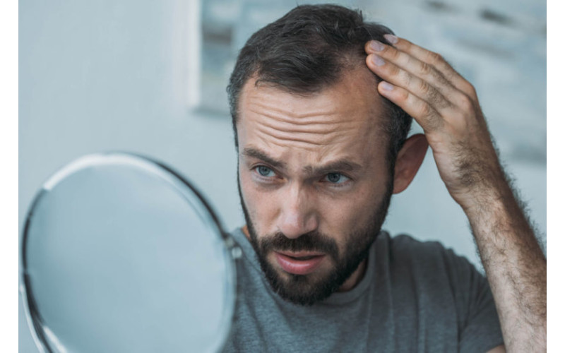 Como evitar a queda de cabelo em homens?
