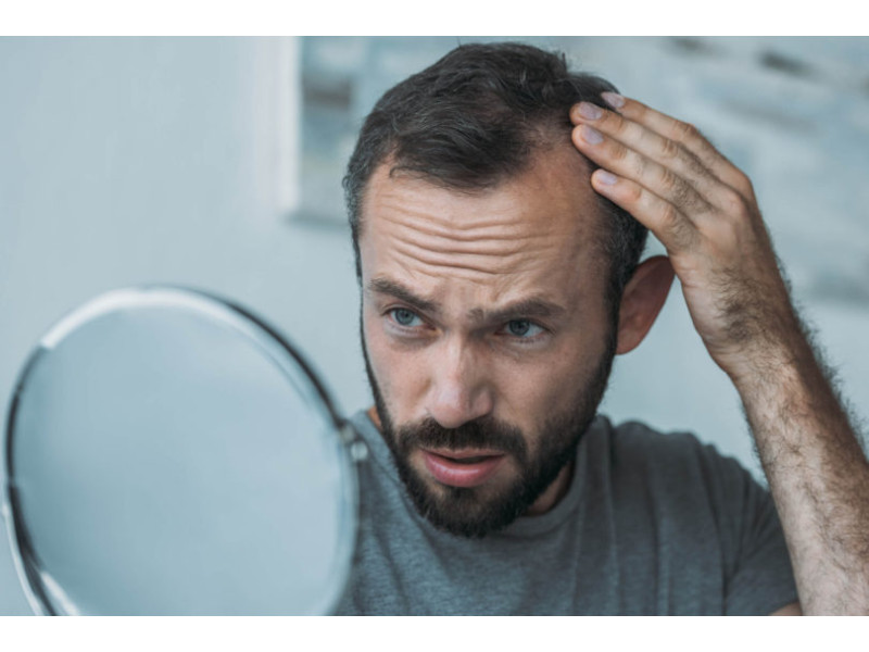 Como evitar a queda de cabelo em homens?